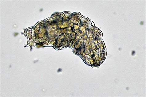  Cryptosporidium! Have You Heard Of This Tiny Troublemaker Lurking In Water?